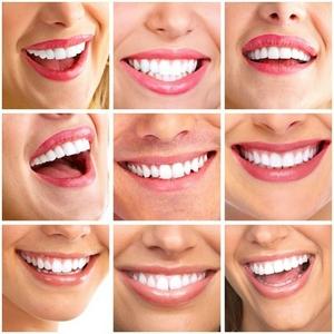зубные виниры perfect smile veneers